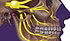Trigeminal Nevralji